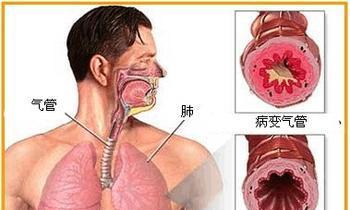 拆卸空调的注意事项（保护环境）